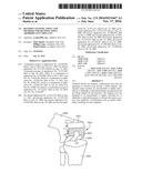 Revision Systems, Tools and Methods for Revising Joint Arthroplasty     Implants diagram and image