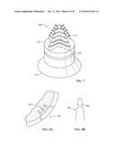 Revision Systems, Tools and Methods for Revising Joint Arthroplasty     Implants diagram and image