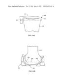 Revision Systems, Tools and Methods for Revising Joint Arthroplasty     Implants diagram and image