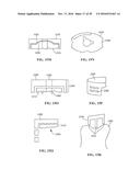 Revision Systems, Tools and Methods for Revising Joint Arthroplasty     Implants diagram and image