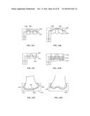 Revision Systems, Tools and Methods for Revising Joint Arthroplasty     Implants diagram and image