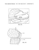 Revision Systems, Tools and Methods for Revising Joint Arthroplasty     Implants diagram and image