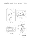 Revision Systems, Tools and Methods for Revising Joint Arthroplasty     Implants diagram and image