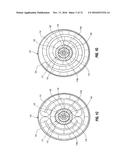 PERCUTANEOUS TRANSCATHETER REPAIR OF HEART VALVES VIA TRANS-APICAL ACCESS diagram and image