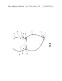 PERCUTANEOUS TRANSCATHETER REPAIR OF HEART VALVES VIA TRANS-APICAL ACCESS diagram and image