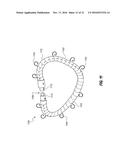 PERCUTANEOUS TRANSCATHETER REPAIR OF HEART VALVES VIA TRANS-APICAL ACCESS diagram and image