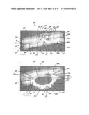 EXPANDABLE INTERVERTEBRAL IMPLANTS AND METHODS OF INSTALLATION THEREOF diagram and image