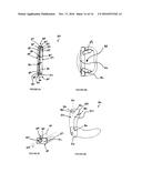 EXPANDABLE INTERVERTEBRAL IMPLANTS AND METHODS OF INSTALLATION THEREOF diagram and image