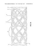 BIOABSORBABLE POLYMERIC MEDICAL DEVICE diagram and image