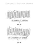 BIOABSORBABLE POLYMERIC MEDICAL DEVICE diagram and image