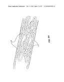 BIOABSORBABLE POLYMERIC MEDICAL DEVICE diagram and image