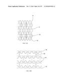 BIOABSORBABLE POLYMERIC MEDICAL DEVICE diagram and image