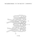 BIOABSORBABLE POLYMERIC MEDICAL DEVICE diagram and image