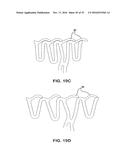 BIOABSORBABLE POLYMERIC MEDICAL DEVICE diagram and image