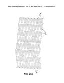 BIOABSORBABLE POLYMERIC MEDICAL DEVICE diagram and image