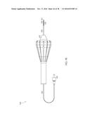 STEERABLE LASER PROBE diagram and image