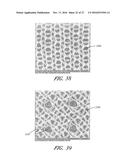 WOUND DRESSING AND METHOD OF TREATMENT diagram and image