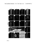 THERAPEUTIC USE OF VEGFR-3 LIGANDS diagram and image