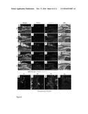 THERAPEUTIC USE OF VEGFR-3 LIGANDS diagram and image