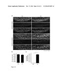 THERAPEUTIC USE OF VEGFR-3 LIGANDS diagram and image