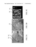 BONE REGENERATION USING BIODEGRADABLE POLYMERIC NANOCOMPOSITE MATERIALS     AND APPLICATIONS OF THE SAME diagram and image
