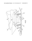 REMOTELY ADJUSTABLE DEGREES OF FREEDOM FOR SUSPENSION COUPLING diagram and image