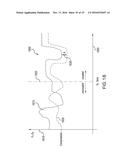 REMOTELY ADJUSTABLE DEGREES OF FREEDOM FOR SUSPENSION COUPLING diagram and image