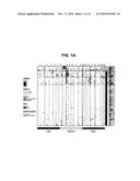 Biopsy-Driven Genomic Signature for Prostate Cancer Prognosis diagram and image