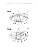 CONNECTING DEVICE AND METHOD FOR CONNECTING TWO PARTS diagram and image