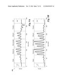 PHOTONIC SENSOR FOR IN SITU SELECTIVE DETECTION OF COMPONENTS IN A FLUID diagram and image