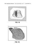 PHYSIOLOGICAL MAPPING FOR ARRHYTHMIA diagram and image