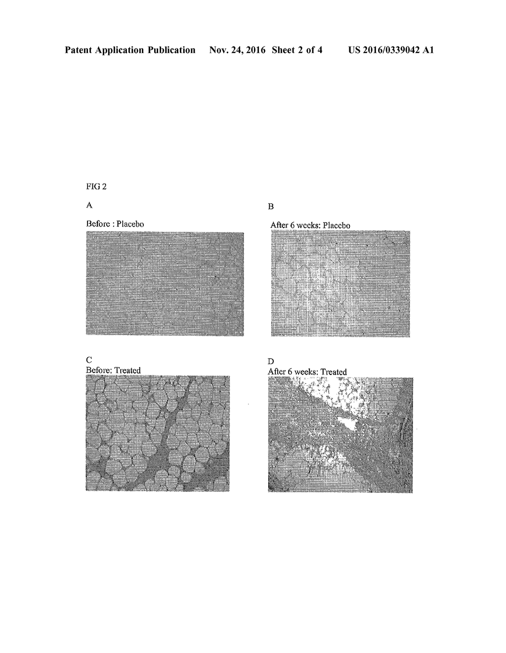 TOPICAL LIPOLYSIS COMPOSITIONS AND METHODS - diagram, schematic, and image 03