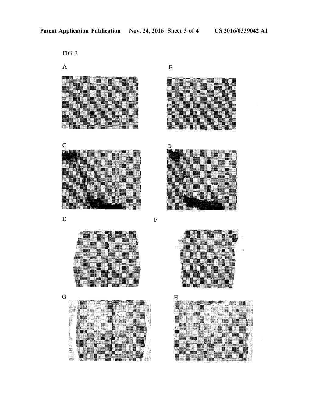 TOPICAL LIPOLYSIS COMPOSITIONS AND METHODS - diagram, schematic, and image 04