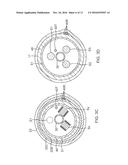 CATHETER WITH ADJUSTABLE DEFLECTION diagram and image