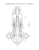 CATHETER WITH ADJUSTABLE DEFLECTION diagram and image