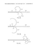 CATHETER WITH ADJUSTABLE DEFLECTION diagram and image