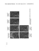 PROTECTIVE AGENT FOR ELECTRON MICROSCOPIC OBSERVATION OF BIOLOGICAL SAMPLE     IN WATER-CONTAINING STATE, KIT FOR ELECTRON MICROSCOPIC OBSERVATION,     METHODS FOR OBSERVATION, DIAGNOSIS, EVALUATION, AND QUANTIFICATION BY     ELECTRON MICROSCOPE, AND SAMPLE STAGE diagram and image