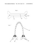 MULTI-PURPOSE HANDLE ENCASEMENT ACCESSORY diagram and image