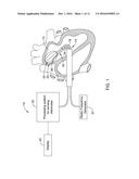 MEDICAL DEVICES FOR MAPPING CARDIAC TISSUE diagram and image