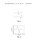 ARTIFACT CANCELLATION TO SUPPRESS FAR-FIELD ACTIVATION DURING     ELECTROPHYSIOLOGY MAPPING diagram and image