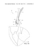 RE-ARMING APPARATUS FOR A MINIMALLY INVASIVE SURGICAL SUTURING DEVICE diagram and image