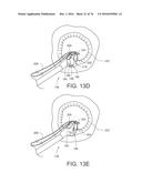 RE-ARMING APPARATUS FOR A MINIMALLY INVASIVE SURGICAL SUTURING DEVICE diagram and image