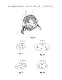 THIXOTROPIC OXIDIZED CELLULOSE SOLUTIONS AND MEDICAL APPLICATIONS THEREOF diagram and image