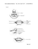 FACIAL IDENTIFICATION TECHNIQUES diagram and image