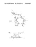 POSITIONING DEVICE FOR EYE SURGERY AND PROCEDURES diagram and image