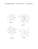 POSITIONING DEVICE FOR EYE SURGERY AND PROCEDURES diagram and image