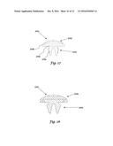 GRIP/COVER FOR KEY LOCK SYSTEM diagram and image