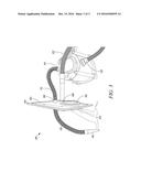 PORTABLE VACUUM CLEANING APPARATUS FOR A COMBUSTION CHAMBER diagram and image