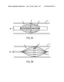 DEVICE AND METHOD FOR VIRTUAL ANGIOGRAPHY diagram and image