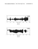 METHOD AND APPARATUS FOR REMOVING MOTION ARTIFACTS FROM BIOMEDICAL SIGNALS diagram and image